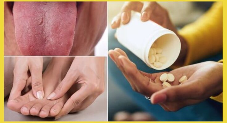 Vitamin B12 deficiency