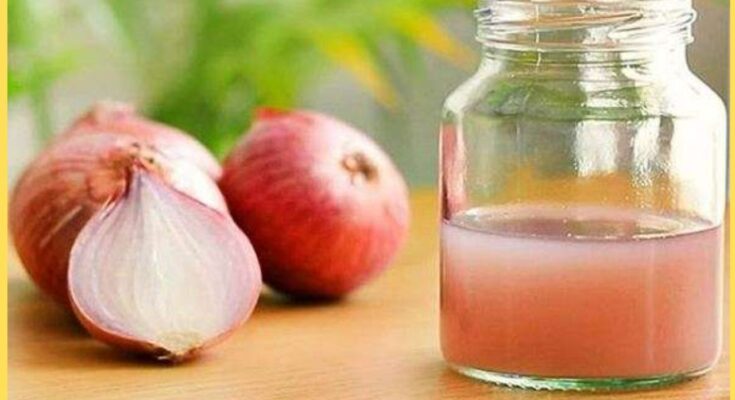 Onion juice for hair