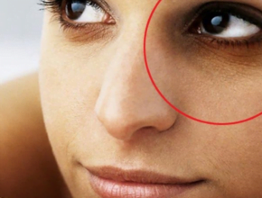 under eye