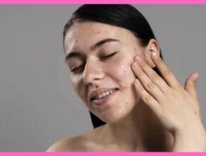 Skin Diseases