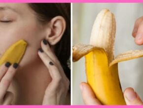 Skin Care With Banana Peel