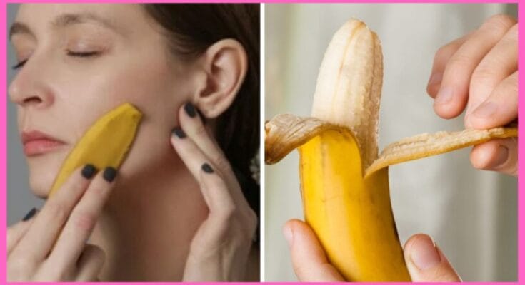 Skin Care With Banana Peel