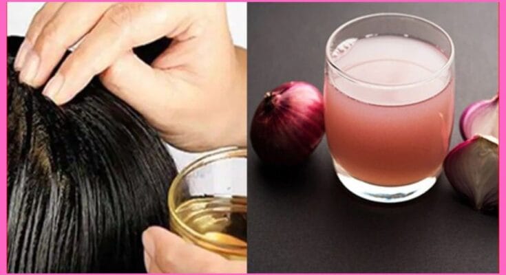 Hair Growth with Onion