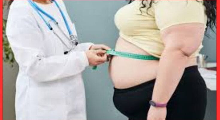 Home Remedies for Obesity