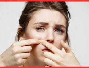 Home remedy for pigmentation