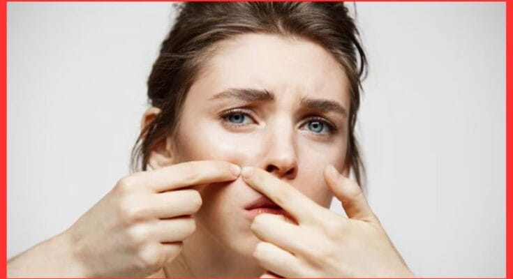 Home remedy for pigmentation