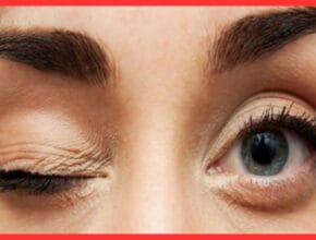 Female Right Eye Blinking