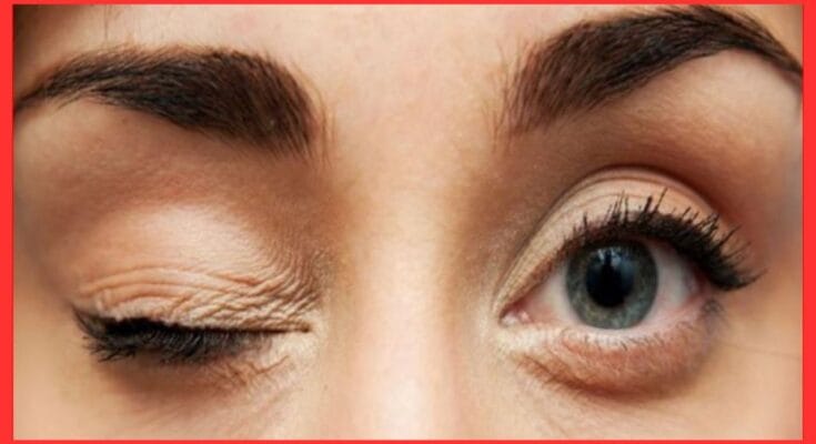 Female Right Eye Blinking