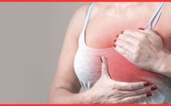 Breast Cancer