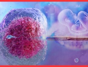 In Vitro Fertilization