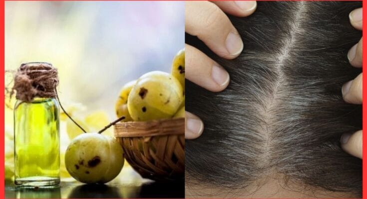 Benefits of Amla for hair